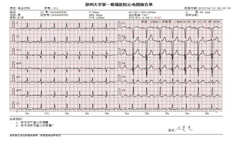这种新药,院内就应启动治疗了