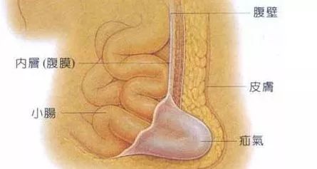 勿以病小而不医勿以病大而自弃,勿以小而不为