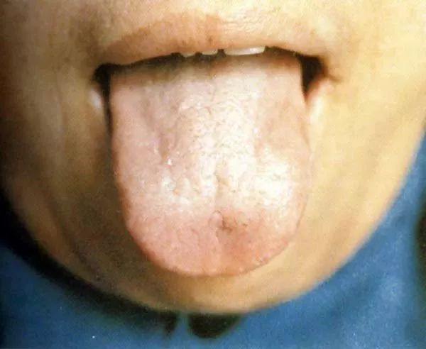 全血细胞减少疾病，你还傻傻分不清？