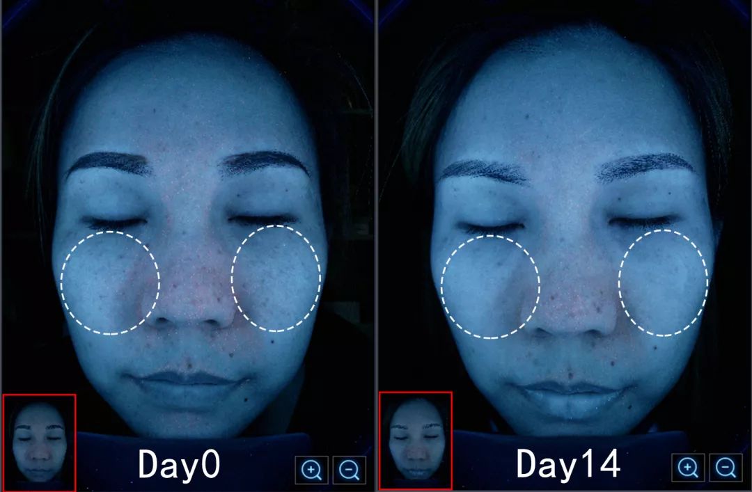 盲测|微整不急!先试试黑科技抗老面霜