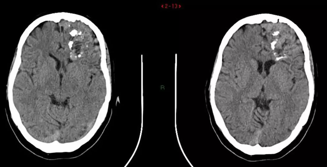 神经影像,神经影像解剖图