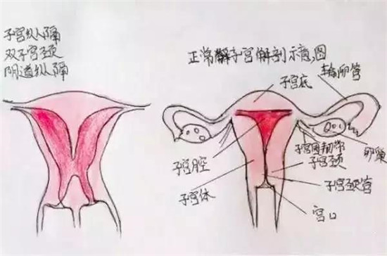 雅安恒博医院提醒:子宫有这道“墙”需及时“拆除”