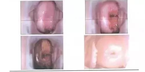 专坑女性的6个健康骗局,专坑女性