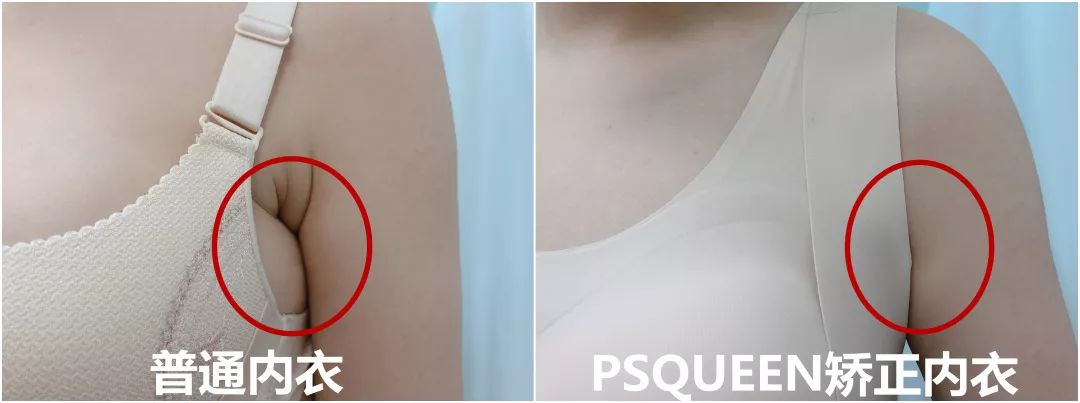 99%的女生都可能得的妇科疾病,99%的女生所不知道的小秘密