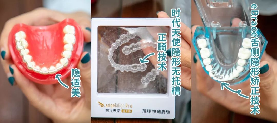 种牙免费送,种牙优惠活动免费检查是真的吗