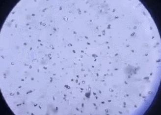 消毒凝胶免手洗医院同款,医院专用消毒凝胶免洗