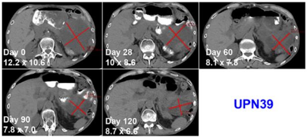 全球首款基于CRISPR基因编辑技术,crisprcas9基因编辑技术发明人