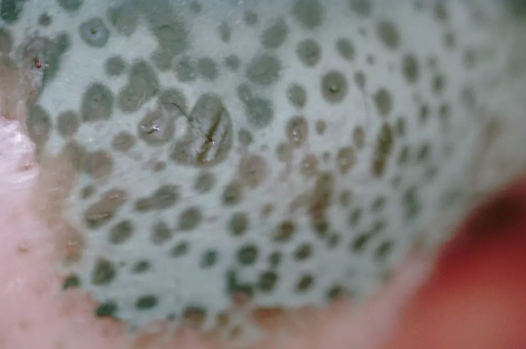 10鍒嗛挓娓呴櫎榛戝ご绮夊埡,榛戝ご绮夊埡鎸ゅ帇娓呯悊姣涘瓟绮楀ぇ