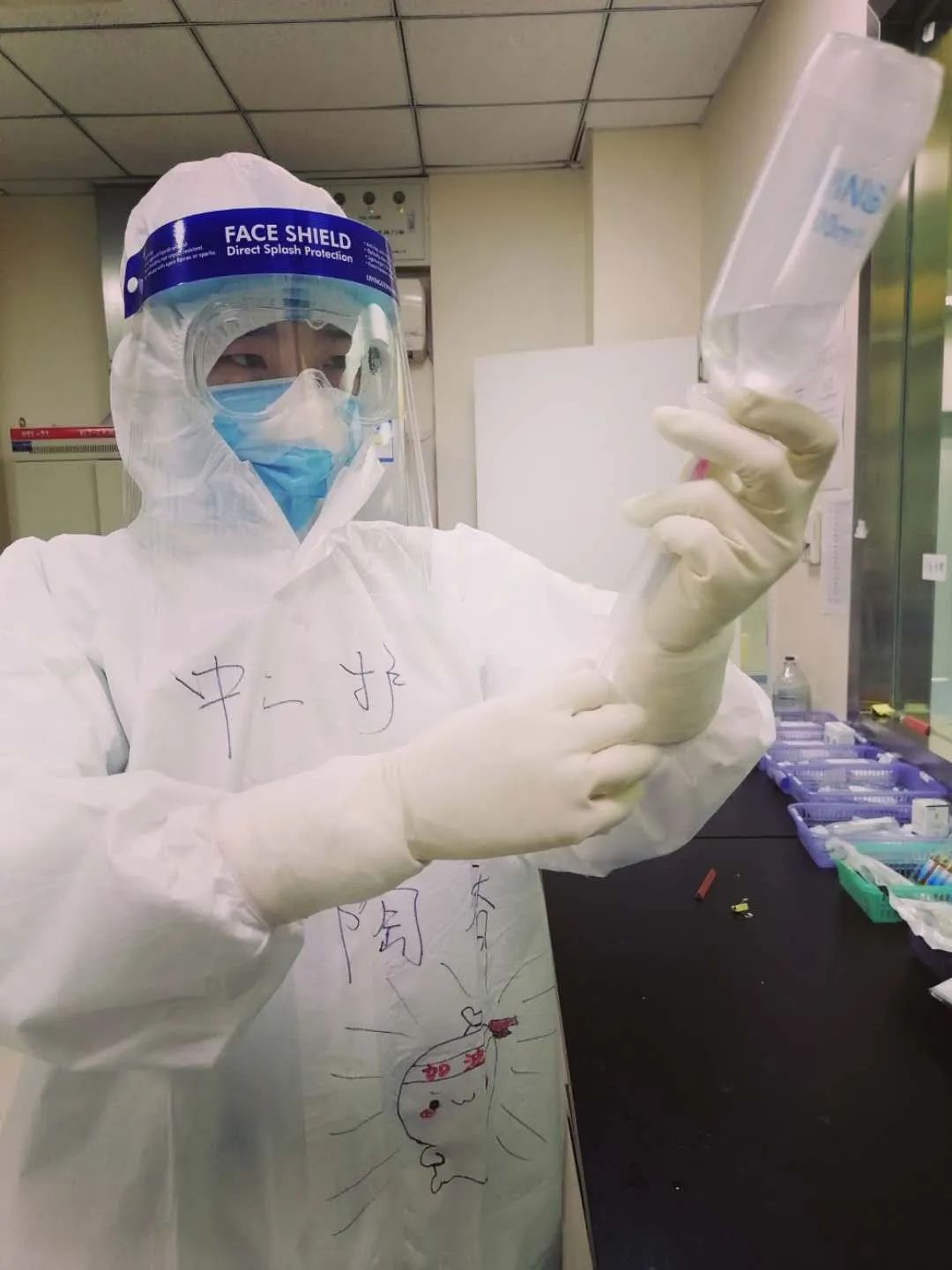 驰援日记:老人经过多天的输液用药,大部分的血管都硬如条索