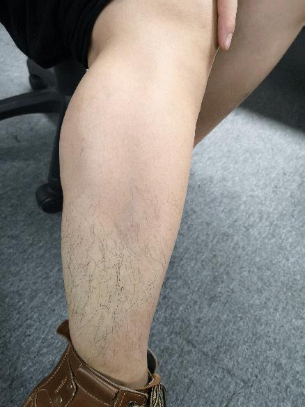 永久脱毛膏既好用又便宜,脱毛膏好用还是刮毛刀好用呢