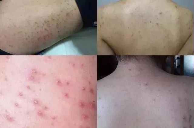 超强搓泥搓澡巾日本制,日式搓澡巾强力搓泥神器