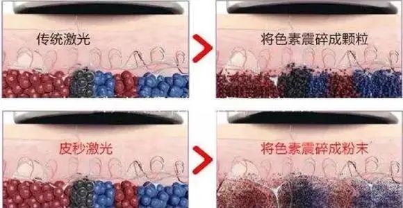 小茂医生护肤品,小茂医生美白护肤品