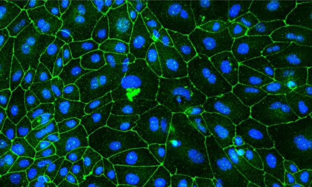 「Cell子刊」人脑实验力证：超声波大大助力老年痴呆治疗，血脑屏障不再是阻碍