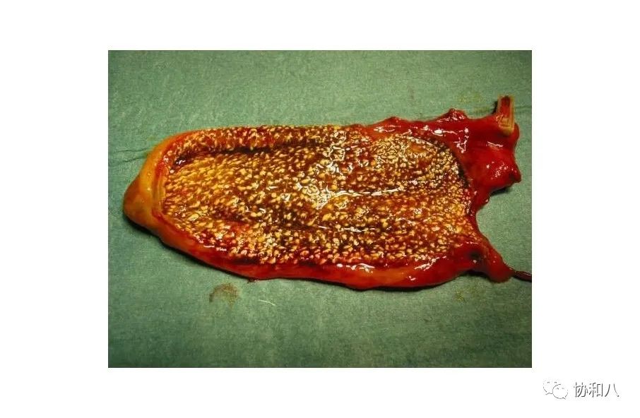 复习这些名解时总觉得怪饿的|协和八·脑洞大开