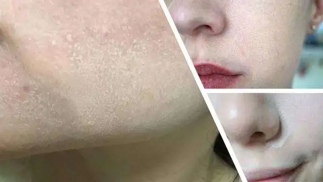 妆前乳推荐干皮不卡粉夏天,网红爆款妆前乳