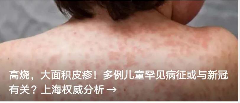 阿迪达斯退出中国市场了吗,阿迪达斯全球超7成门店关闭