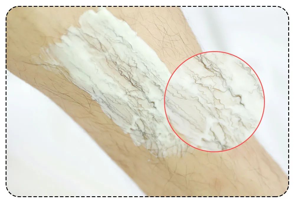 猕猴桃脱毛产品推荐,屈臣氏永久不再生毛的脱毛膏