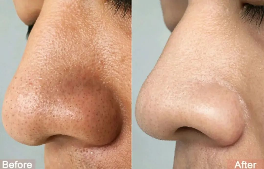 洗出脸上的脏东西解压,清除脸上斑块的产品