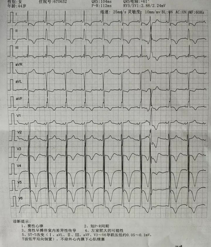 肌钙蛋白一直在持续升高,肌钙蛋白突然偏高的原因