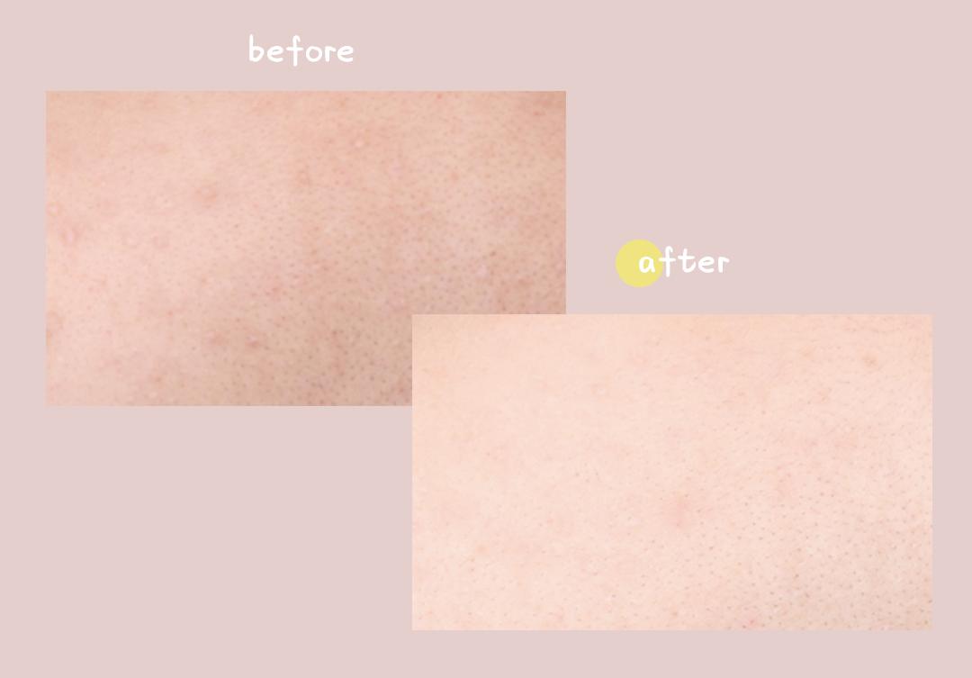 在露肉之前，我要变得白白白！嫩嫩嫩！滑滑滑