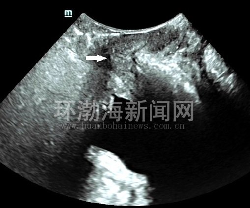 唐山工人医院免费导诊,唐山工人医院看什么病最好
