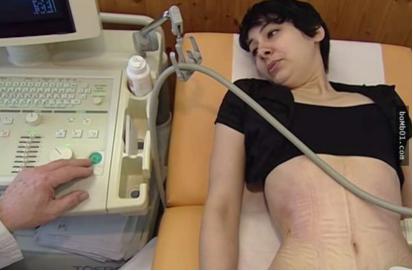 「网红束腰」：全世界有3亿人，在悄悄花钱买死