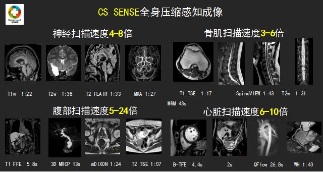 压缩时间、感知精华——西北首台3.0T光速科研型磁共振在我院投入运行