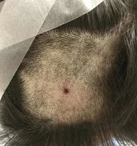 夏天防虫知识100条,夏季防虫叮咬小知识