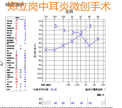 耳朵流脓听力下降需要做手术吗,耳朵流脓不管它会好吗
