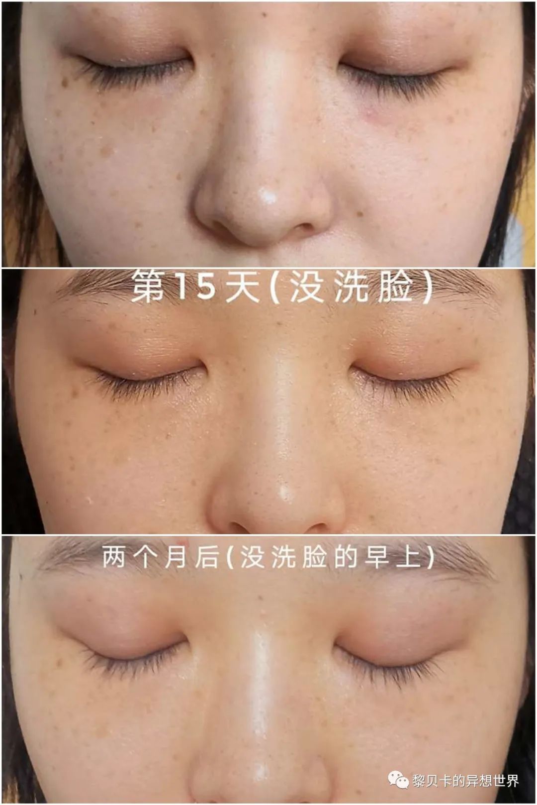 做完医美真的能换脸吗,做完医美需要注意什么