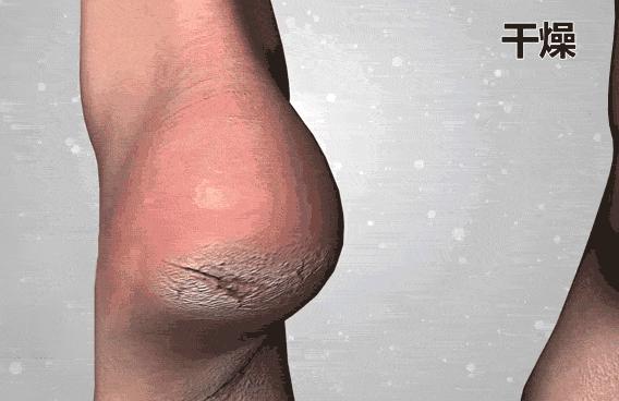 脚臭脱鞋多久可以去味,脱鞋臭脚怎么快速除臭