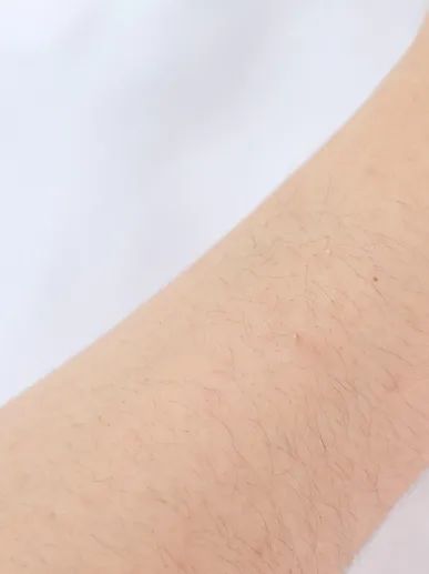 颜值逆袭瘦脸,颜值逆袭瓜子脸