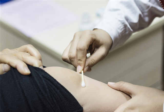 带状疱疹的克星是什么,带状性疱疹的克星