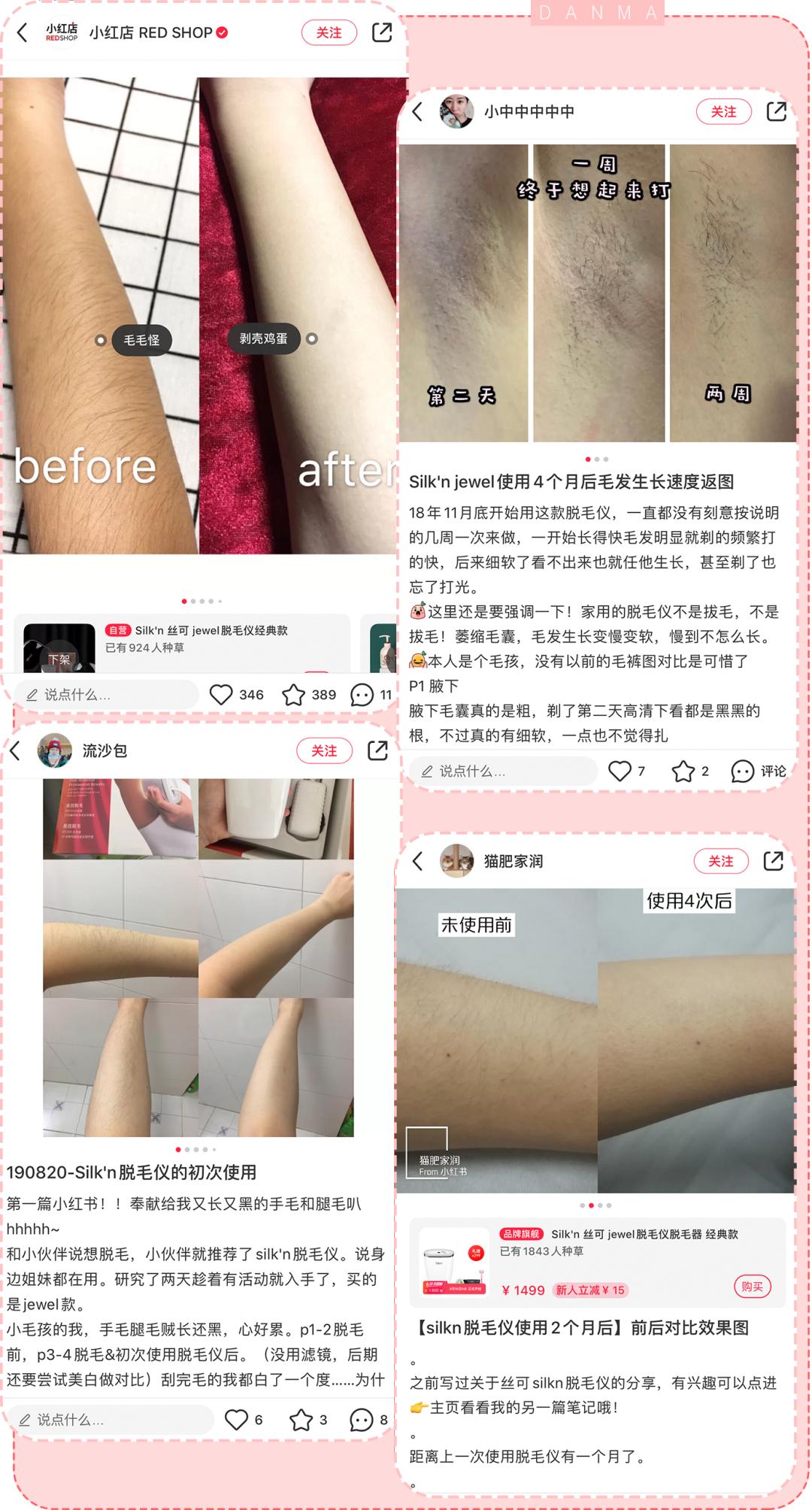 真实脱毛测评,官方测评真正有用的脱毛仪