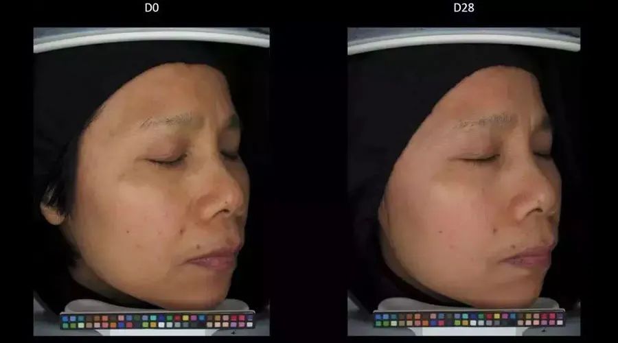 女生变白的正确方式,女生想要变白到底有多简单