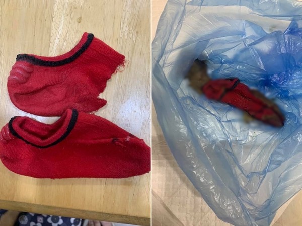 汪星人超爱吞布　医生一句话打脸