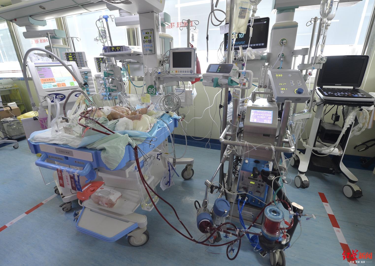 ecmo抢救新生儿,新生儿ecmo抢救无效纪录片