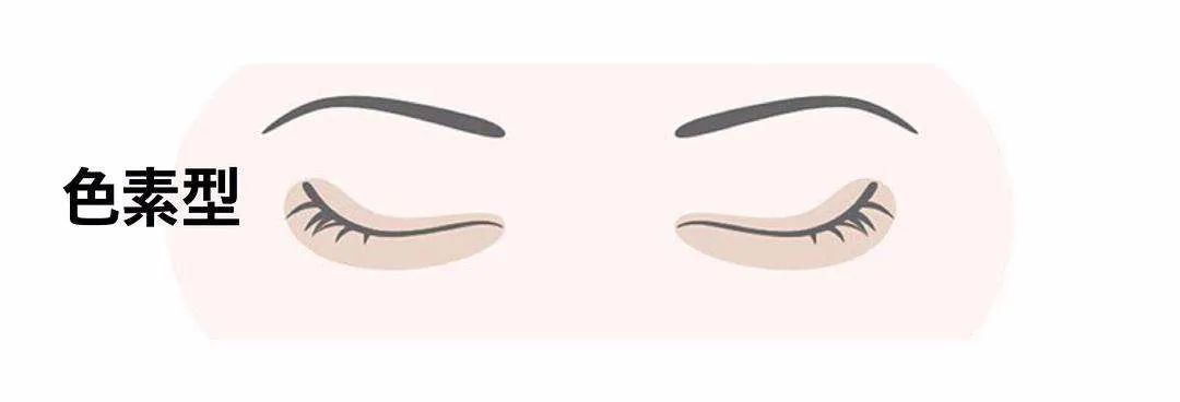 两边黑眼圈程度不一样,黑眼圈的秘密暴露了一个真相