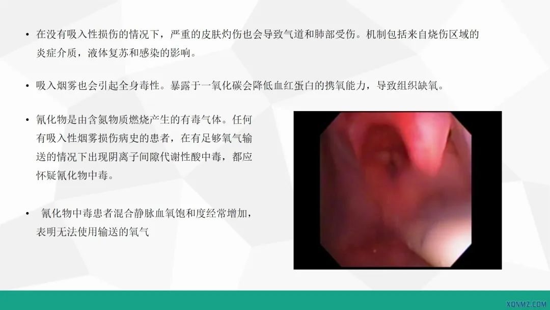 外科烧伤病人的护理教学视频,烧伤患者护理教学查房讲解视频