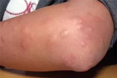 @海南人，看到这种黑色小虫躲远点…