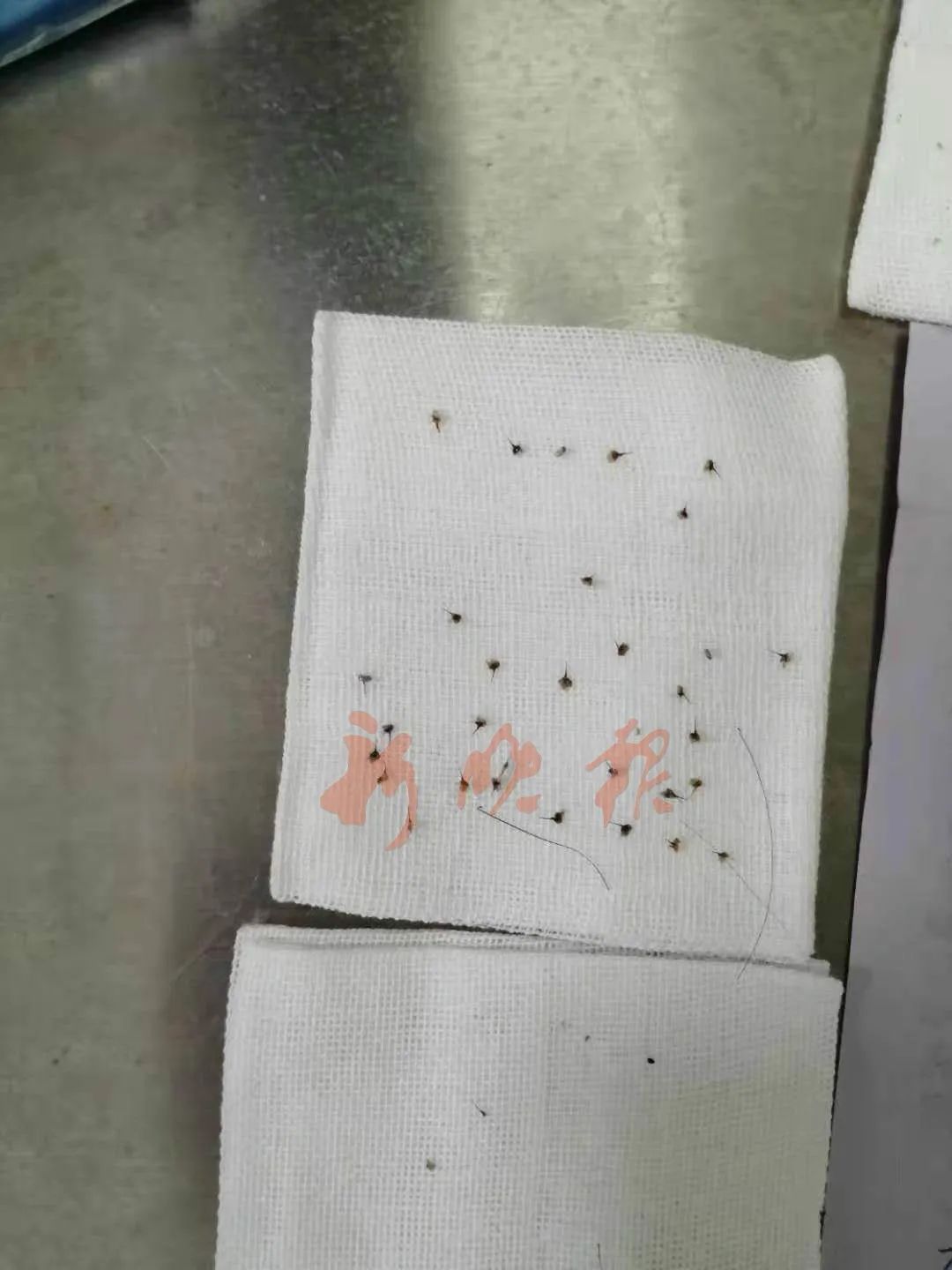 哈尔滨一男子遭蜜蜂“自杀式袭击”，身上拔下40多个蜂针...