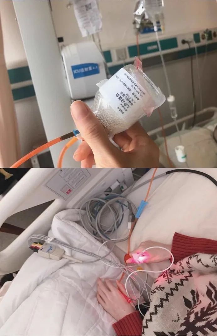 减肥21天icu,减肥到50斤进icu