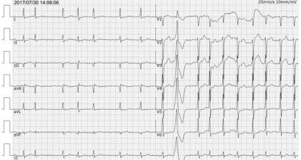 心衰患者睡眠质量差,心衰病人的日常生活现状