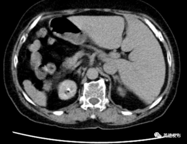 要闻快讯回顾,要闻快讯最新消息