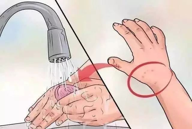 男孩摸了下“花蘑菇”，整个手变黑差点没命！夏天千万当心它