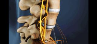 腰痛来龙去脉,腰疼真相