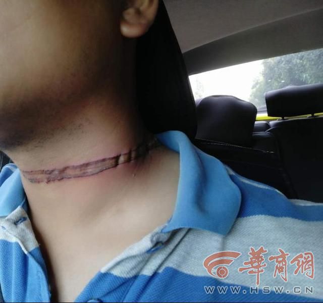 男子骑摩托车被悬空电线锁喉,男子被电线勒脖子
