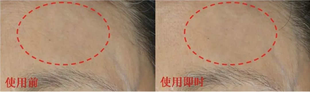 用空瓶回购眼霜,值得空瓶回购的眼霜