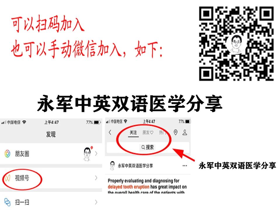 甲状腺毒性周期性麻痹