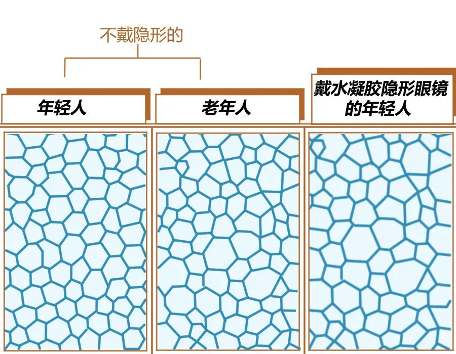 隐形眼镜什么情况下会磨损角膜,隐形眼镜戴多久一般不会影响角膜